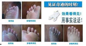 哪些明星有脚气,揭秘脚气困扰的明星阵容